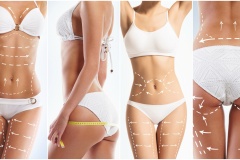 Collage of a female body with arrows. Fat lose, health, sport, fitness, nutrition, liposuction, healthy life-style concept.
